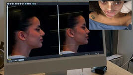 Ергенката Валерия Дакова си клъцна носа СНИМКА