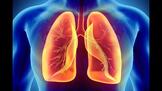 Храни с висок гликемичен индекс повишават риска от рак на белия дроб