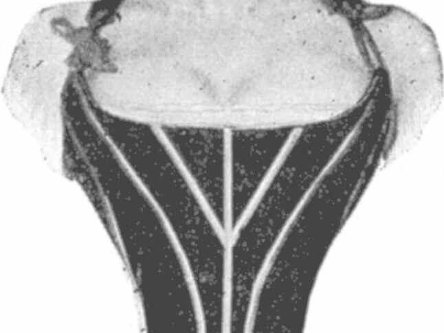 Корсетът отдавна
